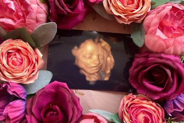 4D scan