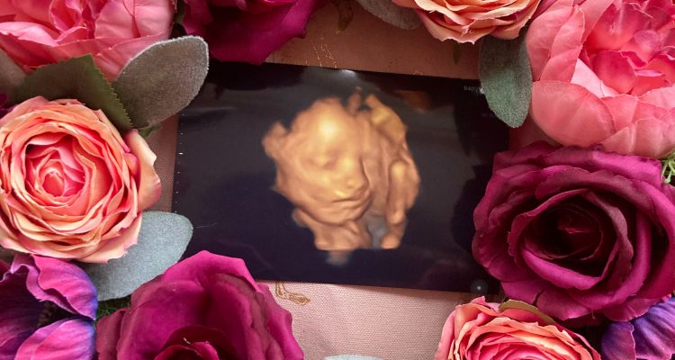 4D scan